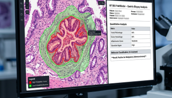 Patologia Digitale 2026: Come l’IA sta trasformando la diagnosi in Anatomia Patologica